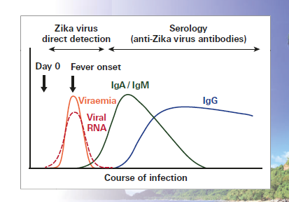 Progression graph of zika infection